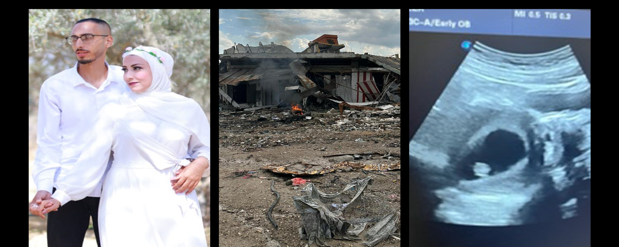 A composite photo shows a couple on their wedding day, a destroyed house and an ultrasound scan of a fetus 