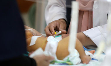 A premature baby receives treatment