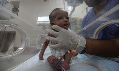 a premature baby in a neonatal intensive care unit