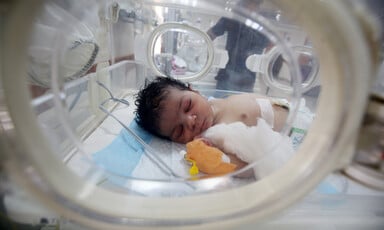 A premature baby in a NICU