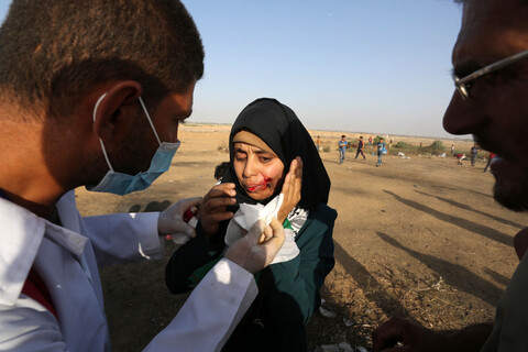 Paramedics treat woman wounded in face
