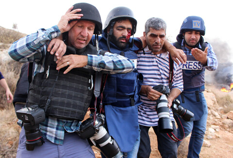 Man with injured eye walks with help of men carrying cameras