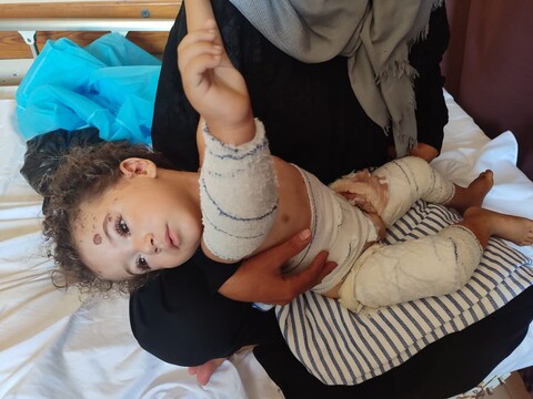 An injured child held by a woman sitting on a hospital bed 