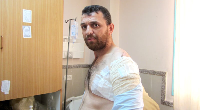 Man with bandages on his upper arm and chest sits in hospital room