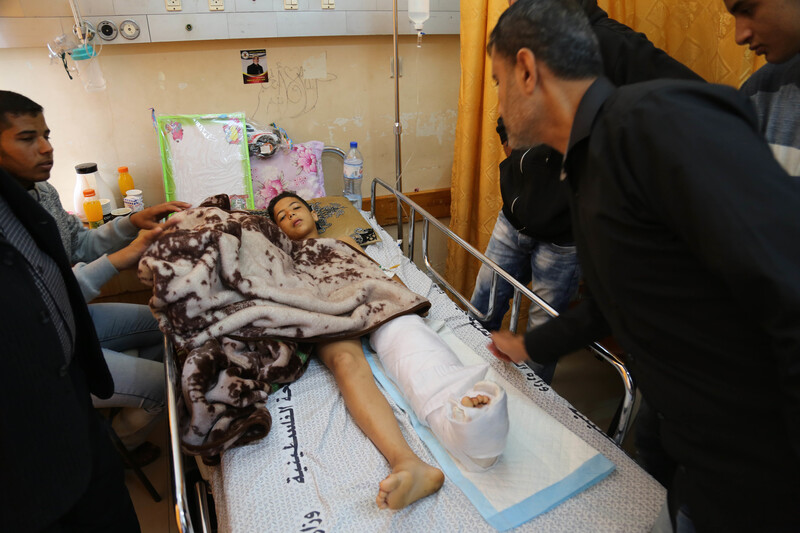 Young boy lies in hospital bed with one of his legs wrapped in a cast