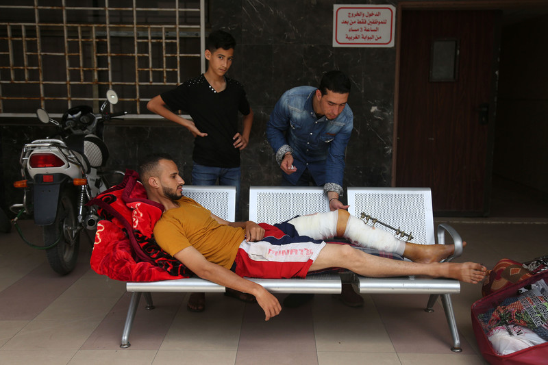 Young man with a metal splint on his legs lies across a bench as two other youths look on