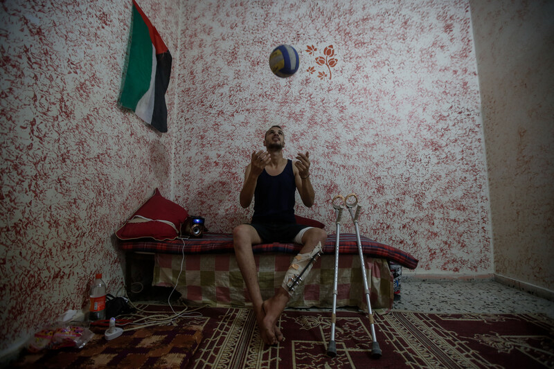 Young man with metal brace on leg smiles as he throws a volleyball in the air while sitting on a small bed