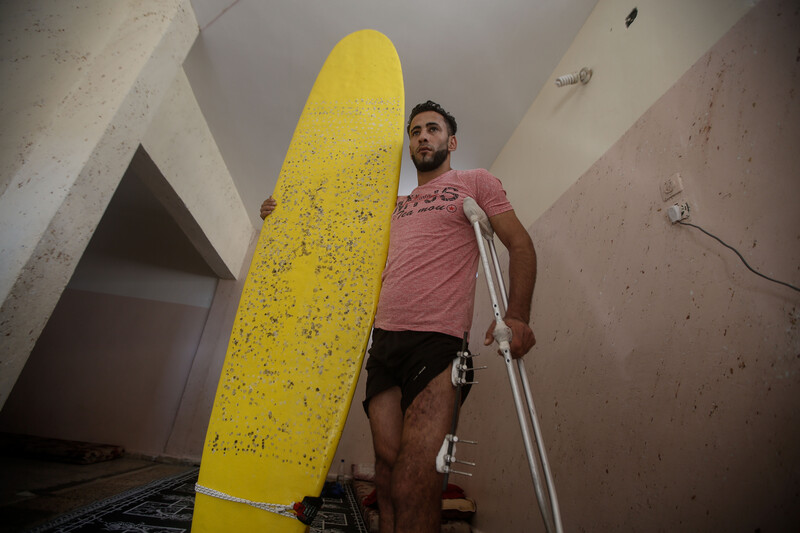 Man wearing t-shirt and shorts holds a surfboard with one arm and supports himself with crutches using his other arm