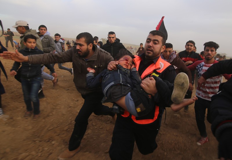 A paramedic carries a small child with blood splattered around his eye as others run alongside them