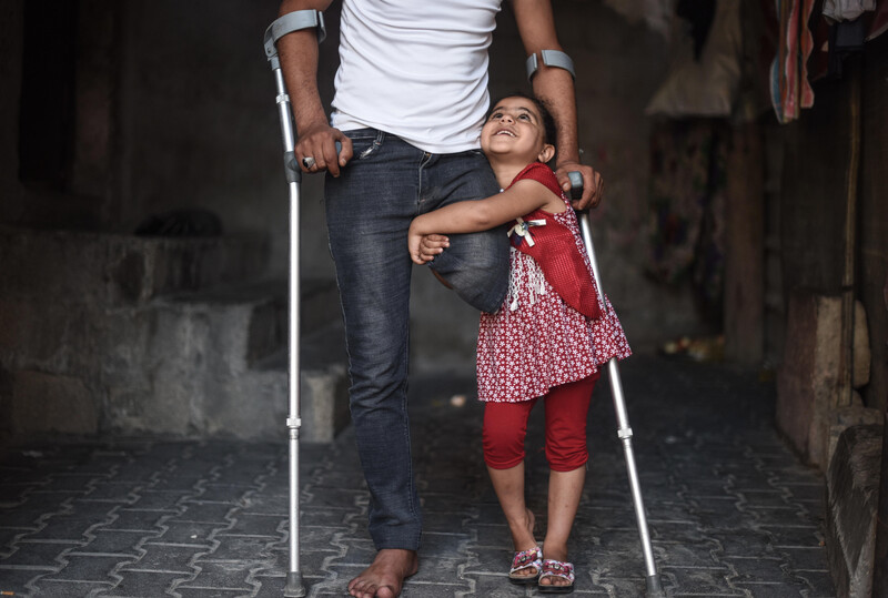 Girl hugs man using crutches seen from chest down