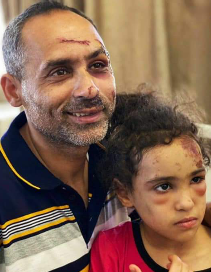 A man holds a girl, both with wounds and scars on their faces 