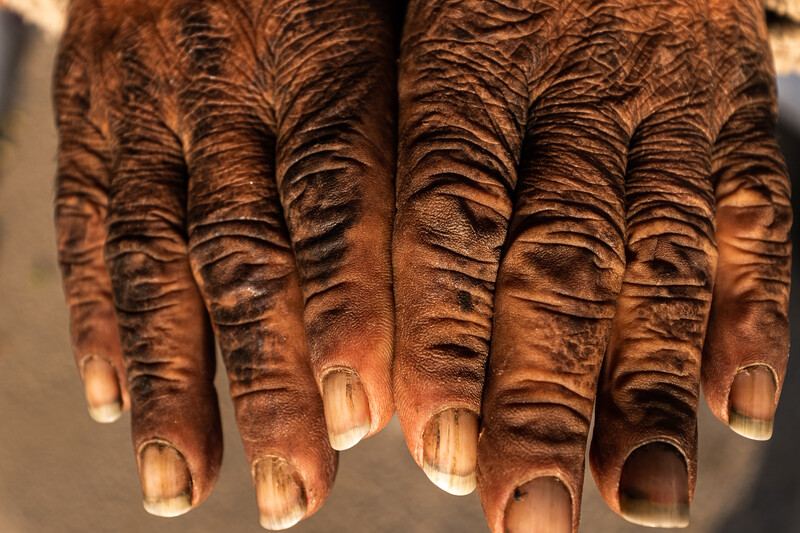 A pair of callused hands