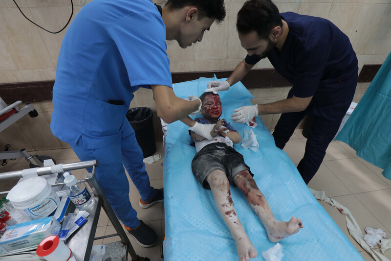 Two men wearing scrubs stand on opposite sides of a kindergarten-aged boy lying on a hospital bed with a bloody face