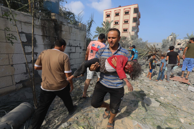 A man carries a young girl with a major injury to her face while walking across road filled with debris