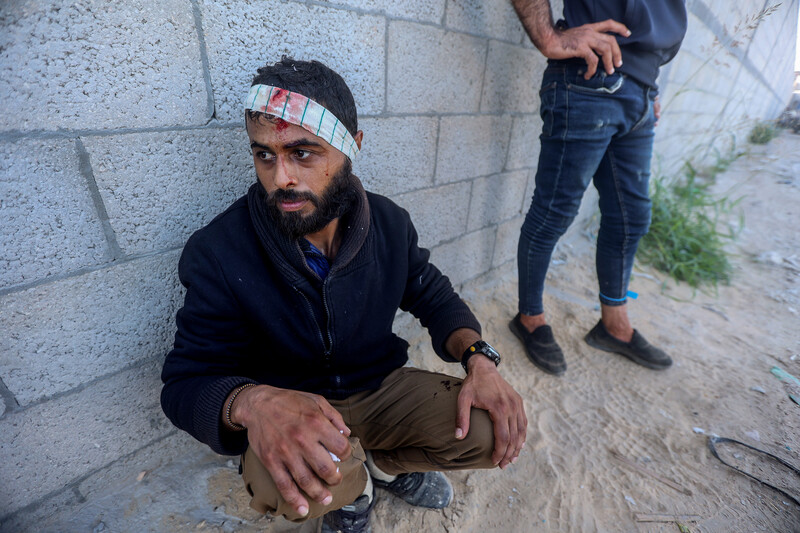 A man sit against a wall with a bandage covering his bleeding forehead while another man stands near him
