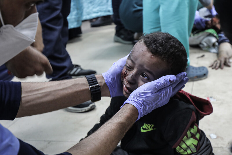 A doctor, wearing gloves, cradles the face of a small wounded child on the floor of a hospital 