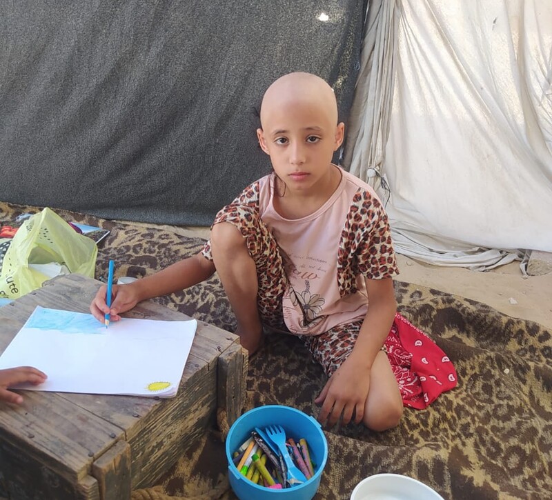 Young girl loses hair amid relentless Israeli aggression