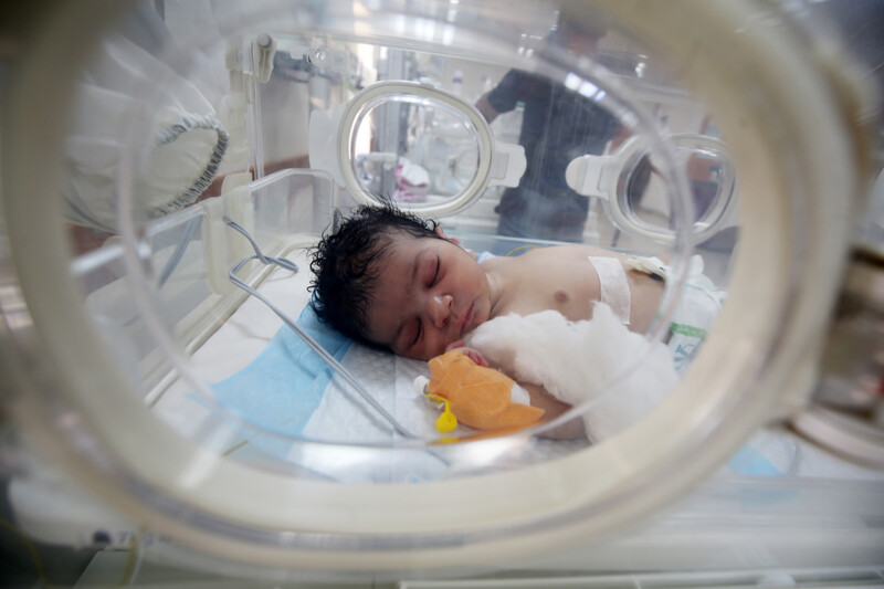 A premature baby in a NICU