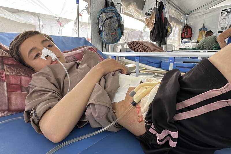 A Palestinian child rests in a hospital bed with tubes connected to his abdomen and nose