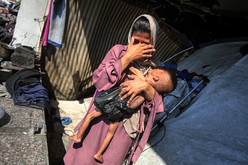 A woman in a pink dress wipes her eyes with one hand and holds her child in the other. The child is severely malnourished and is wearing a black plastic bag as a diaper.