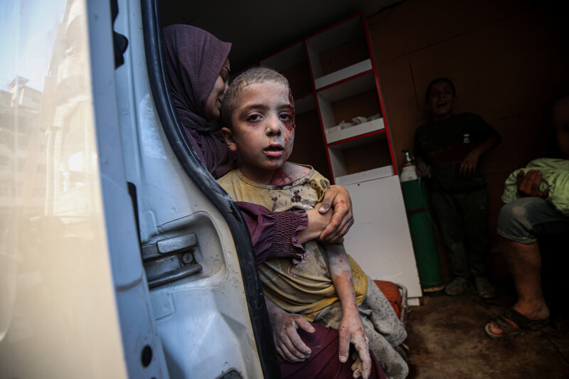 A small boy with dust, ash and blood on his face looks at the camera as he is being held by a woman inside an ambulance.