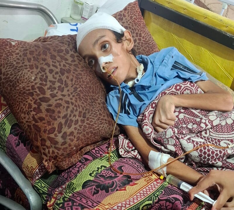 An undernourished child lies in a hospital bed
