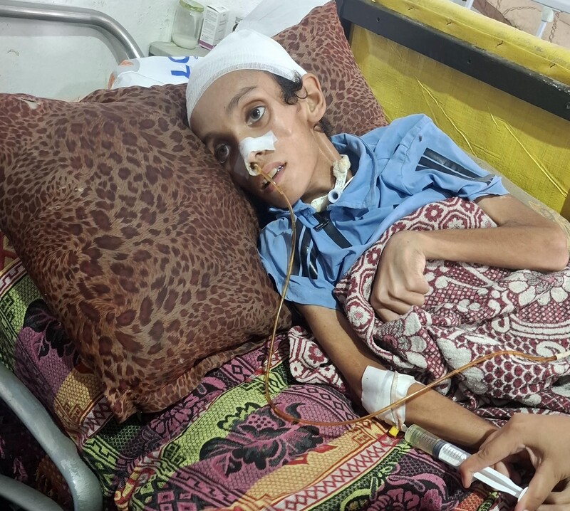 An undernourished child lies in a hospital bed