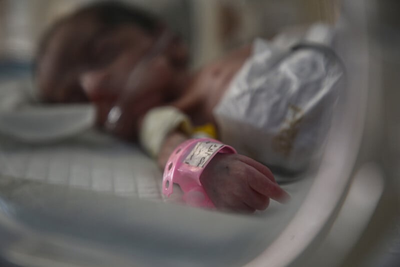 A premature infant in an incubator