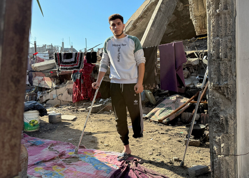 In front of his tent, a man with his left leg amputated leaning on a crutch