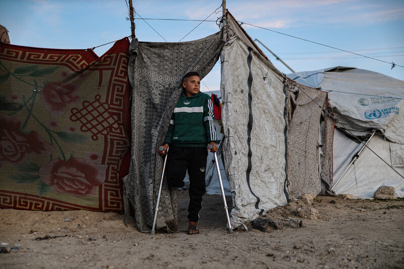 In front of his tent, a boy rests on crutches; one of his legs has been amputated