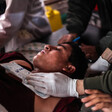 Youth lying on stretcher is seen from chest up as medic applies ice pack on his chest