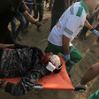 A man with a bandaged and bloody head is carried on a stretcher