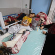 A girl with both of her legs bandaged and one in a splint rests on a bed with a woman sitting next to her