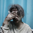 A girl covered in grey dust holds a bandage to her bloodied face while sitting in front of a blue curtain