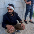 A man sit against a wall with a bandage covering his bleeding forehead while another man stands near him 