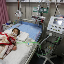 A toddler lies on a hospital bed hooked up to several medical machines and an IV drip.