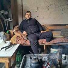 A man sits with his amputated leg on a narrow bed