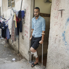 A man with crutches stands in a doorway