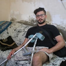 Muhammad Hussein sits on a couch with his forearm canes resting near his amputated leg.
