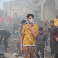A boy with his face covered beside other children following an Israeli attack in Gaza 