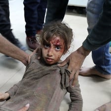 A child with blood on her face 
