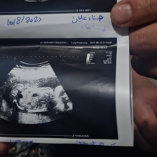 Two hands hold up an ultrasound image 