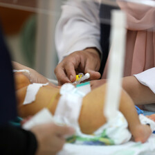 A premature baby receives treatment