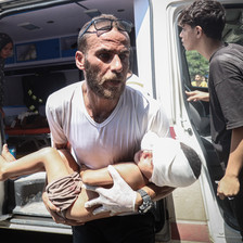 A man carries an injured child out of an ambulance with an older child and woman in the background