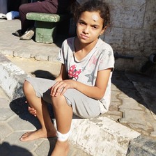 A girl is resting after receiving treatment