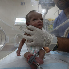 a premature baby in a neonatal intensive care unit