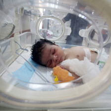 A premature baby in a NICU