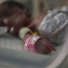 Close-up of the hand of a baby with a breathing tube