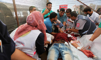 Medics surround a bloodied young man lying on a stretcher
