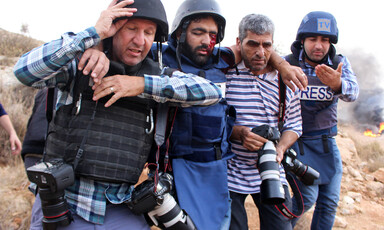 Man with injured eye walks with help of men carrying cameras